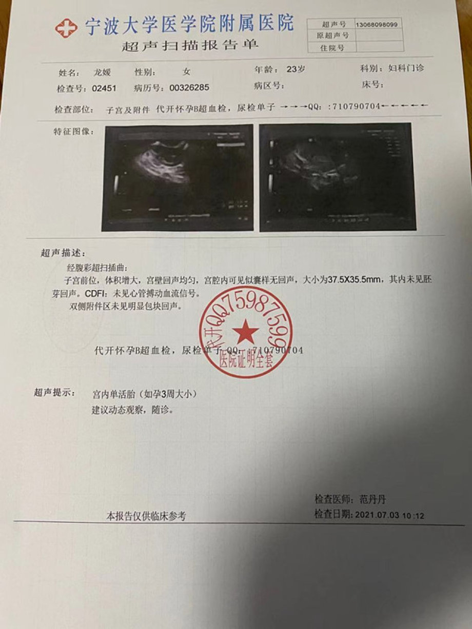 看看怀孕b超报告早孕检查b超报告人工流产证明双胞胎b超诊早孕b超图