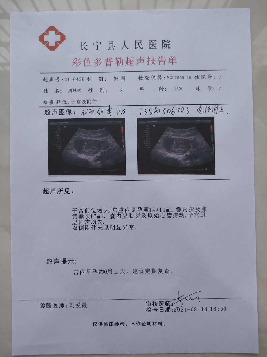 多方b超证明慢性阑尾炎被误诊入院证明d怀孕b超报告单