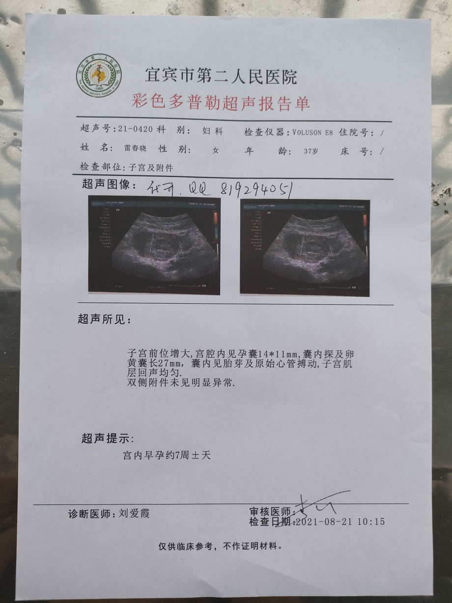 多方b超证明慢性阑尾炎被误诊入院证明d怀孕b超报告单