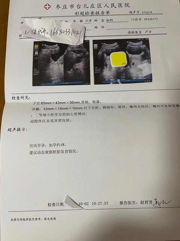 阑尾炎单子彩超报告一个月吉林先兆性流产b超怀孕报告流产b超单的