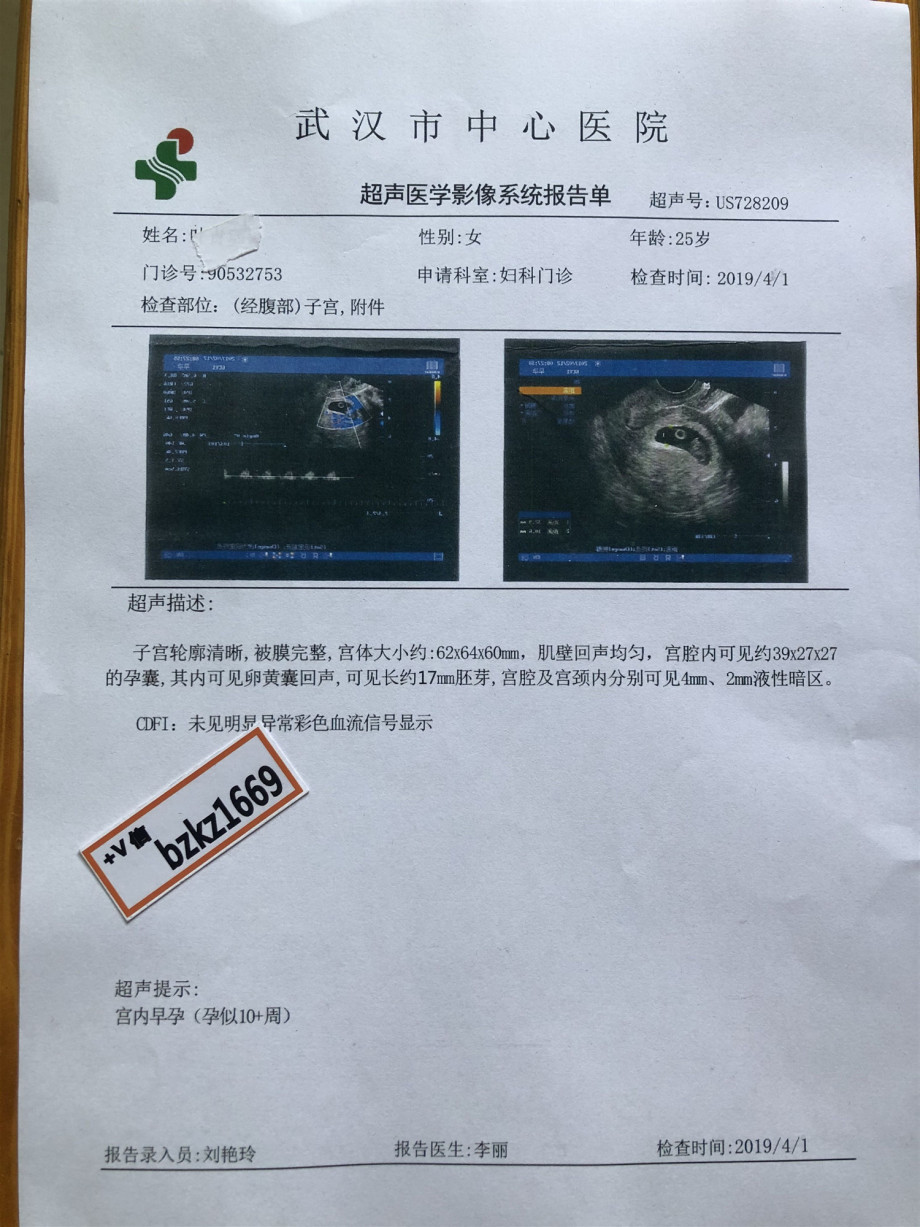 透明早孕b超单诊断证明书妊娠报告怀孕28周照了b超医院开了疾病诊断