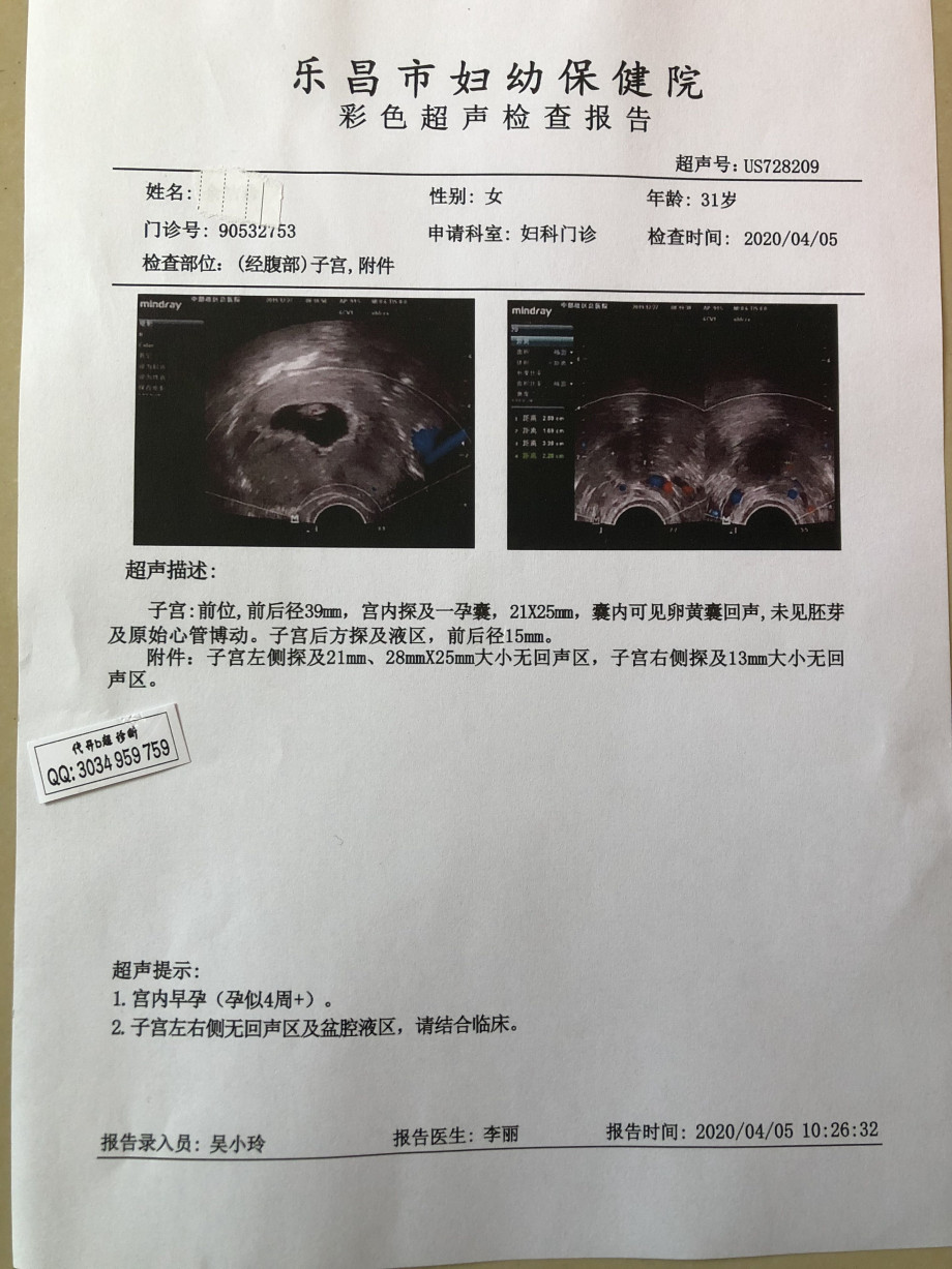 双胞胎孕检b超单与四维彩超报告妊娠证明流产证明化血检验单人流b超