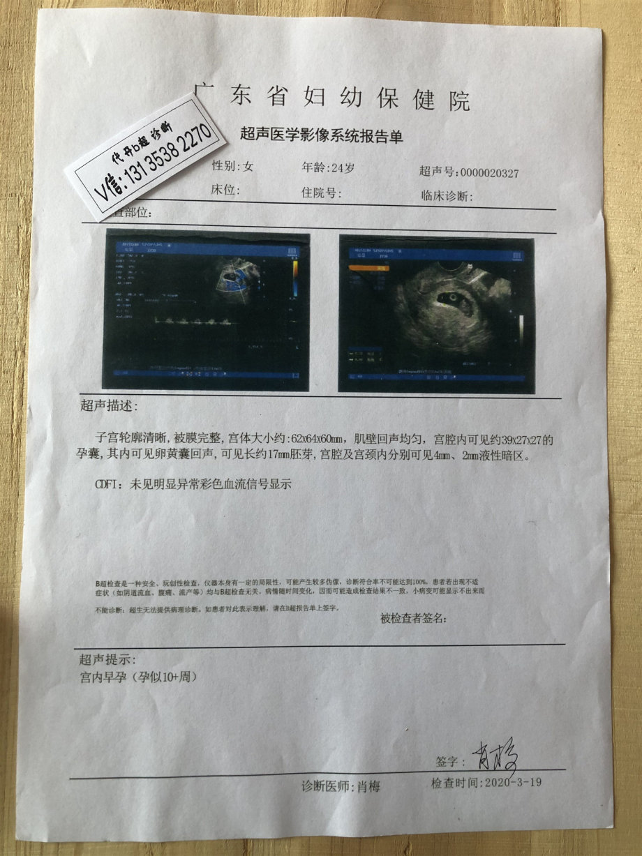 双胞胎孕检b超单与四维彩超报告妊娠证明流产证明化血检验单人流b超