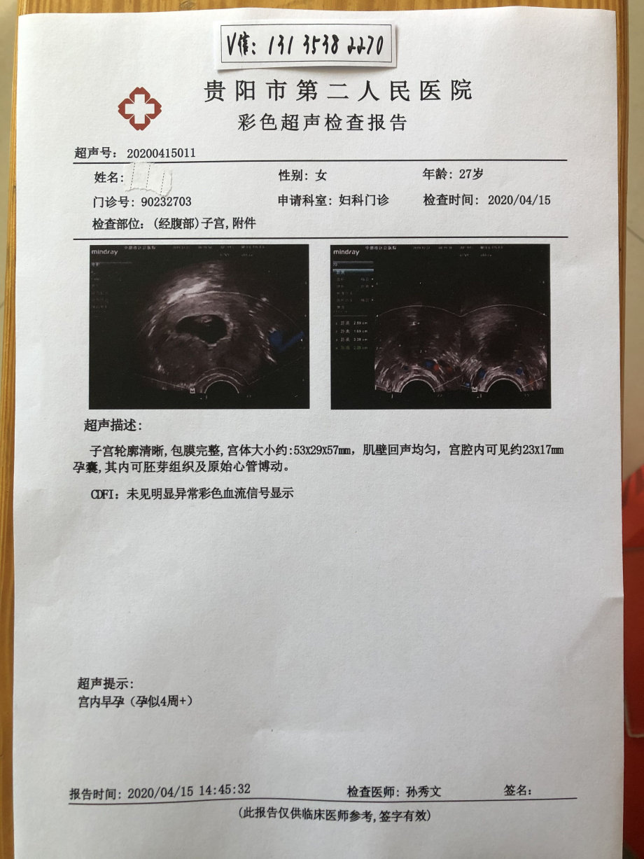 男孩妊娠怀孕6周6天前天检b超无胚芽怀孕b超报告单体检证明化验单证明