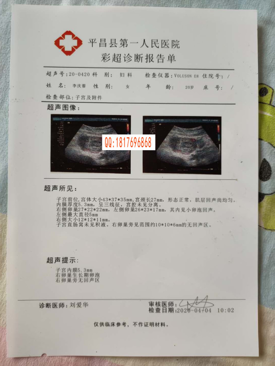 妻子怀孕看b超以为双胞胎欣喜若狂怀孕b超图片30天b超刚怀孕图片怀孕