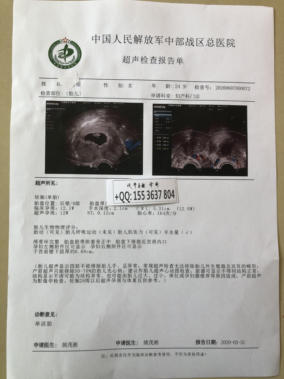 男孩妊娠怀孕6周6天前天检b超无胚芽怀孕b超报告单体检证明化验单证明
