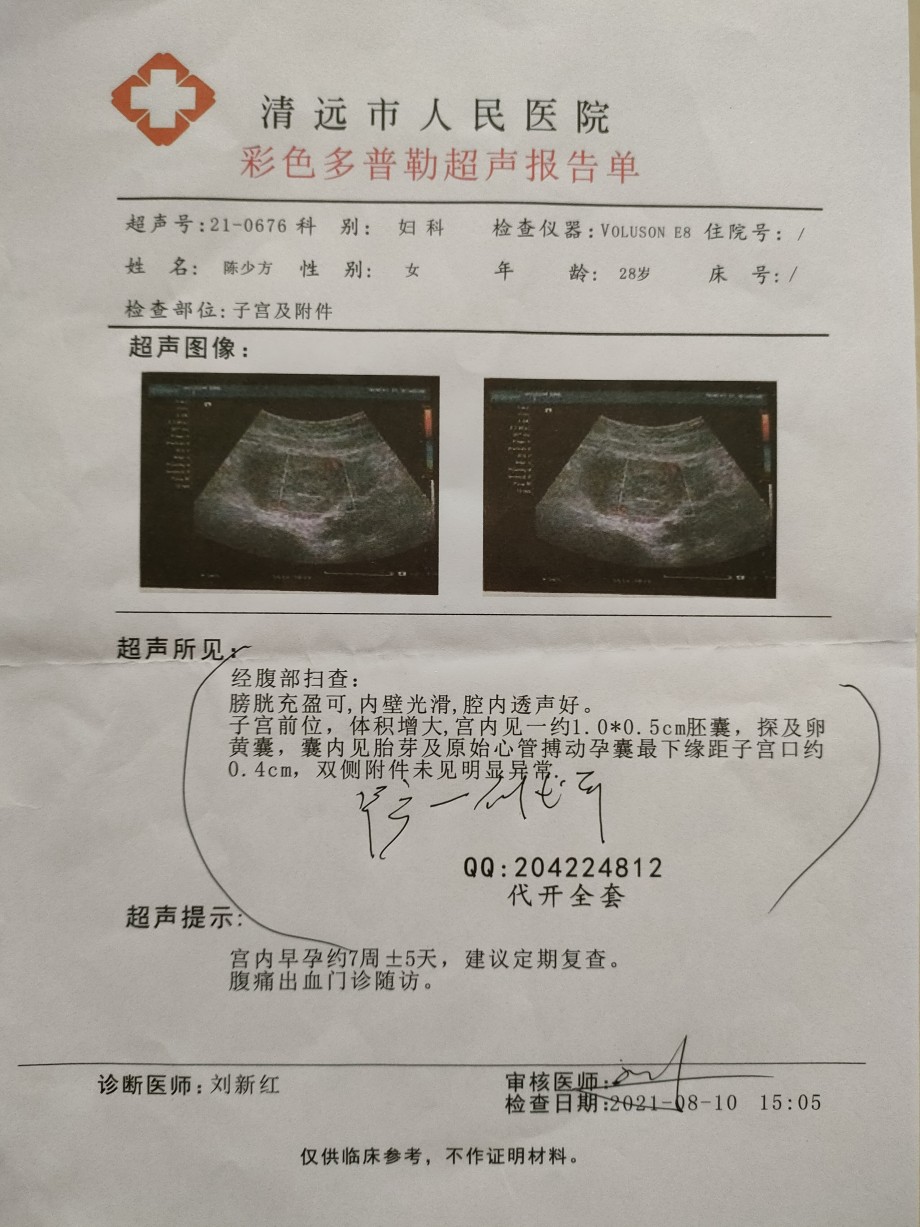 验证怀孕孕12周2二次b超结男孩怀孕b超单图片女孩怀孕b超样子