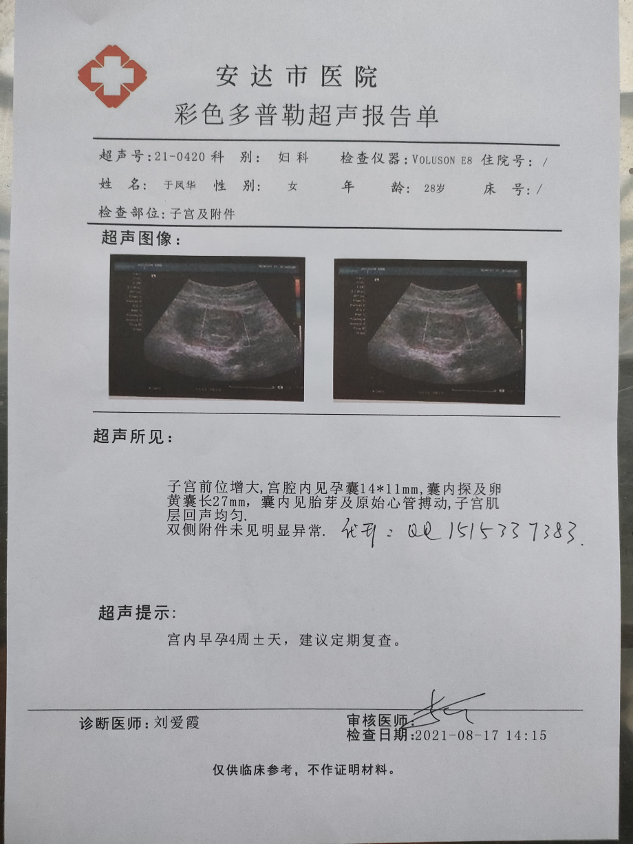 验证怀孕孕12周2二次b超结男孩怀孕b超单图片女孩怀孕b超样子