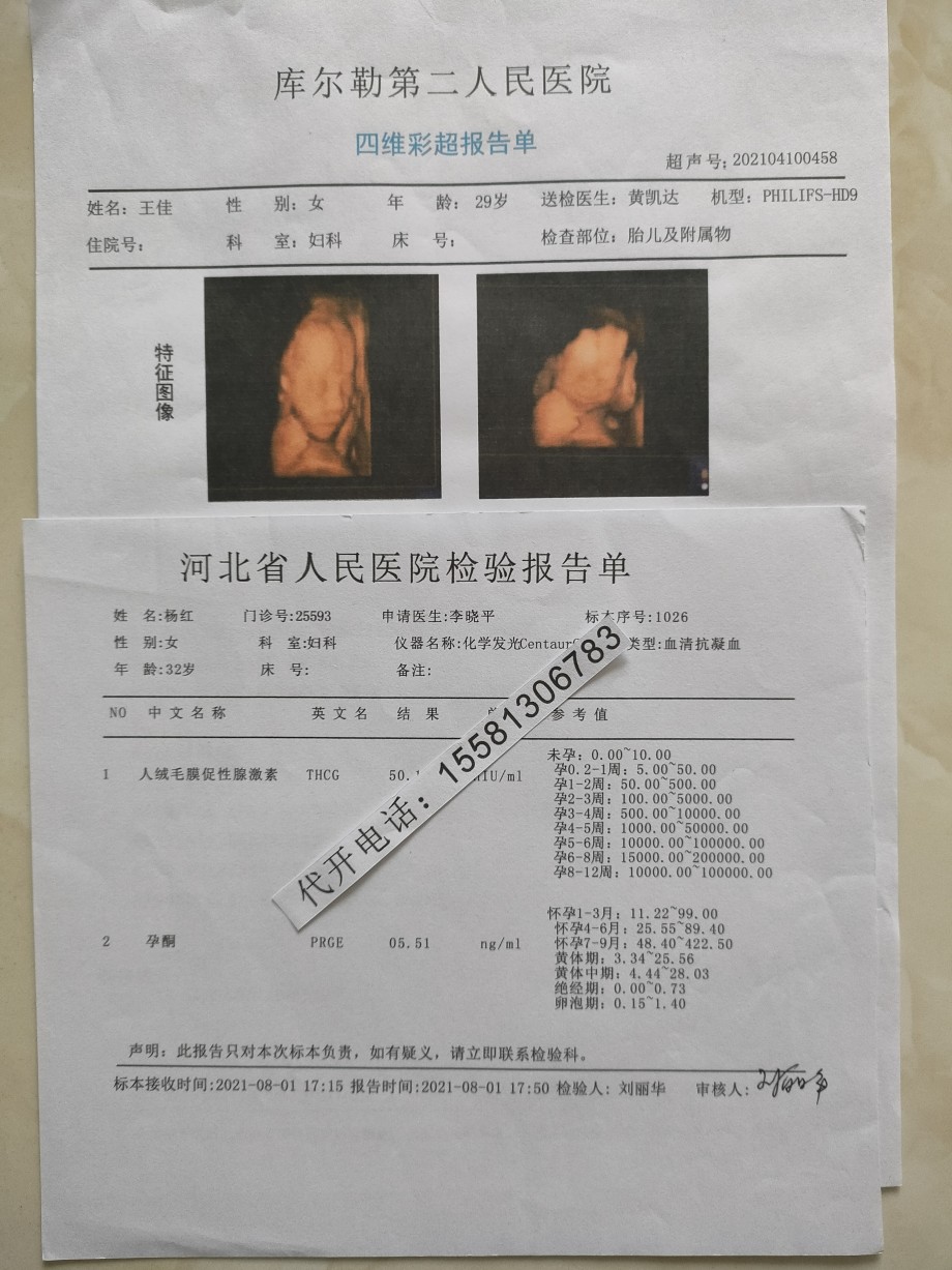 体检社区医院病历记录为孕检b超单与四维彩超报告妊娠