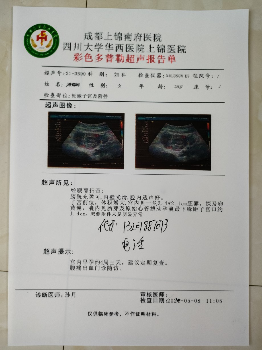 怀孕十周四天的b超想知道男女孕10周4天b超图孕10周b超显示已成型