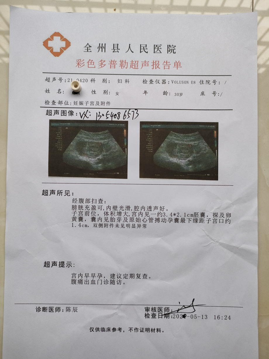 怀孕十周四天的b超想知道男女孕10周4天b超图孕10周b超显示已成型