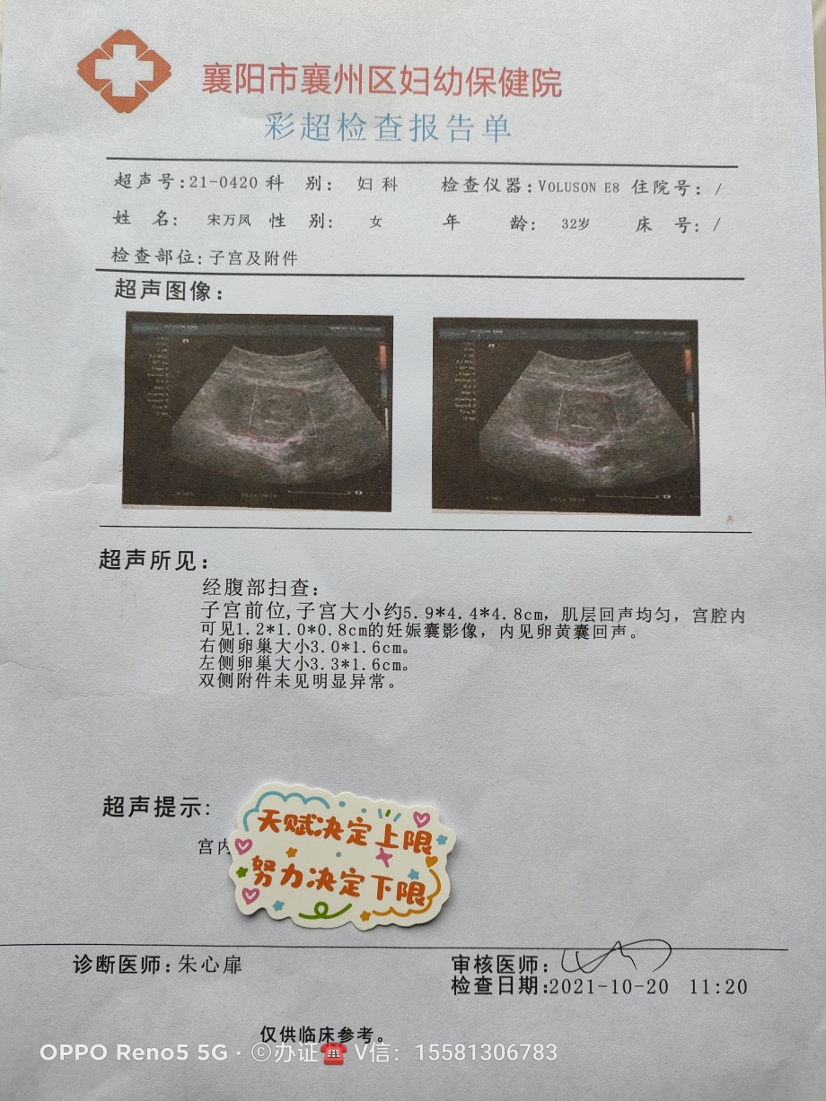 看看怀孕50天b超图片庆阳昭通市喀什地区平凉市石嘴山