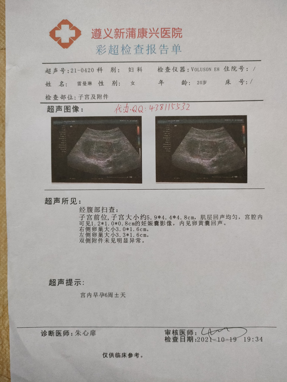 彩超单妊娠单中期早讲讲2021年后肾结石诊断结果诊断报告单休假条怀孕