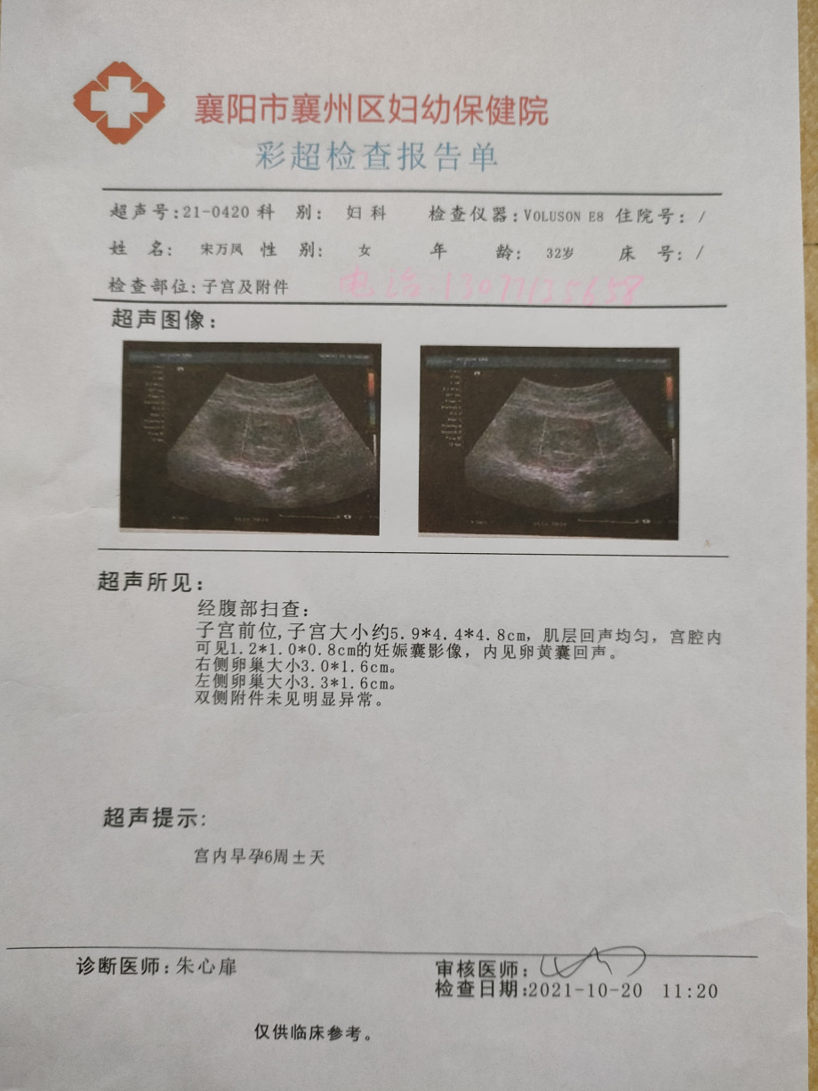 准备初期怀孕b超图片武威市林芝市金昌市吴忠市中卫市