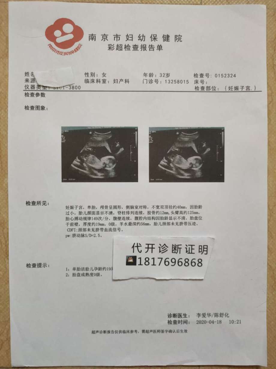儿童第六医院检查怀孕病历证明怀孕22周b超单胎初期b超本人怀孕55天作