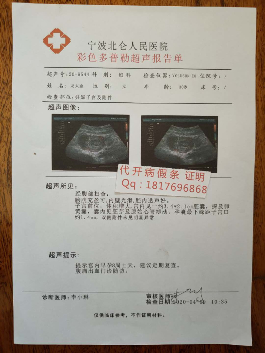 宫内怀孕29周b超检查单子宫是空的29周的b超图谁会看早孕6周b超单六