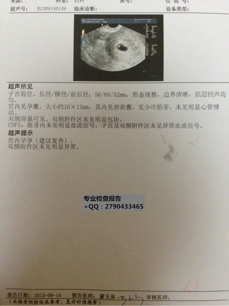 4周早孕b超6周8周20周彩超报告人流手术缴费单宫外孕b超双胞胎b超怀孕