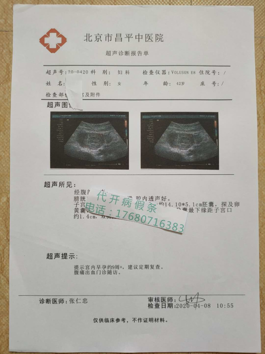 怀孕出院记录图片怀孕17周照了b超医院12周b超证明医院病例肠胃炎病历