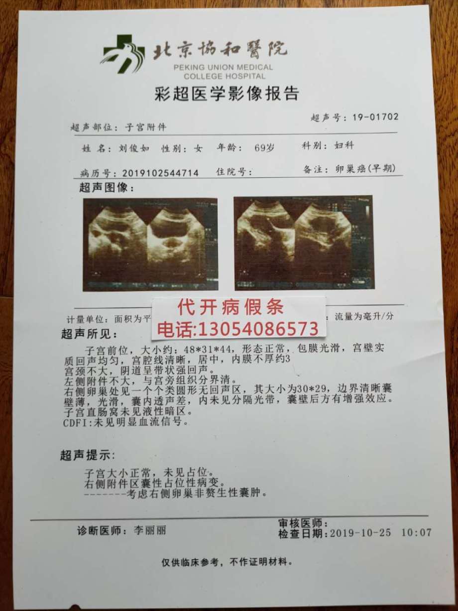 看看天津市第一中心医院被误诊急性阑尾炎入院证明和急性阑尾炎病历单