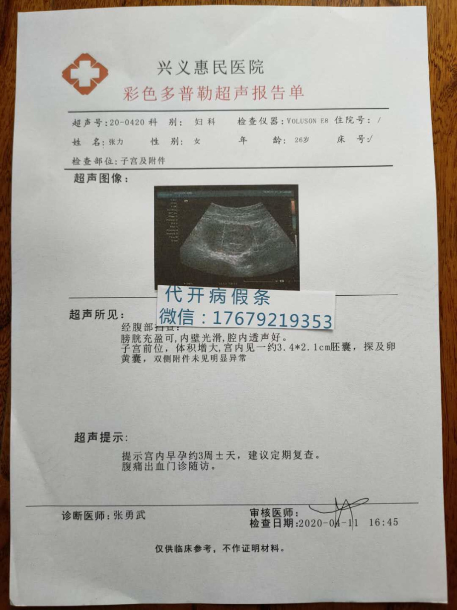 看看天津市第一中心医院被误诊急性阑尾炎入院证明和急性阑尾炎病历单