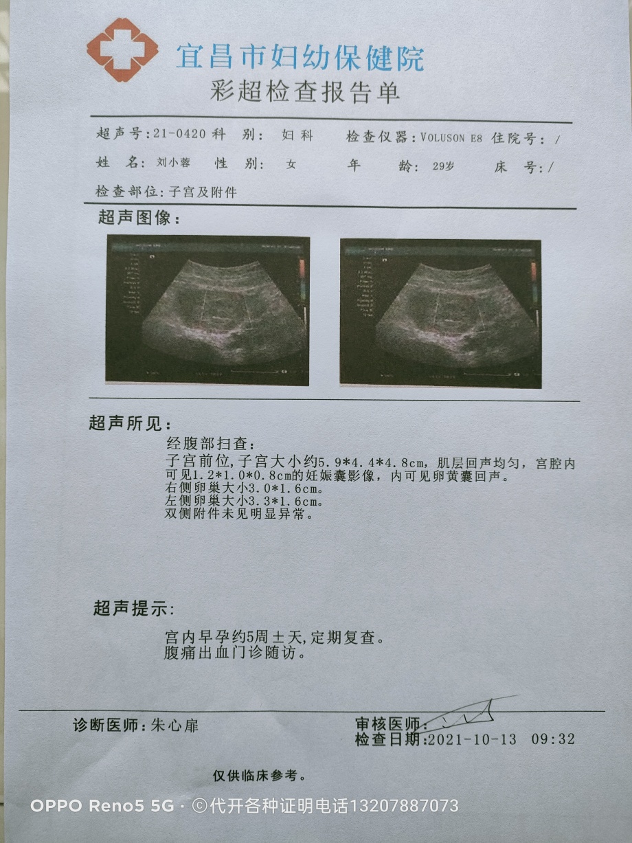 慢性阑尾炎被误诊入院证明和病历单病情证明怀孕b超单图片肺炎诊断