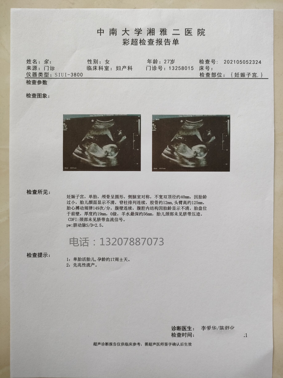 关于上海精神病医院的住院病历记录单中度抑郁症病历唐山医院的大病