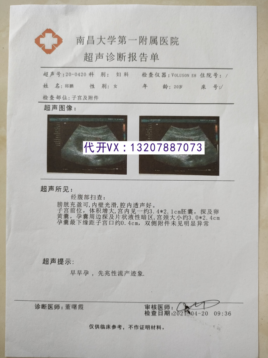 关于上海精神病医院的住院病历记录单中度抑郁症病历唐山医院的大病
