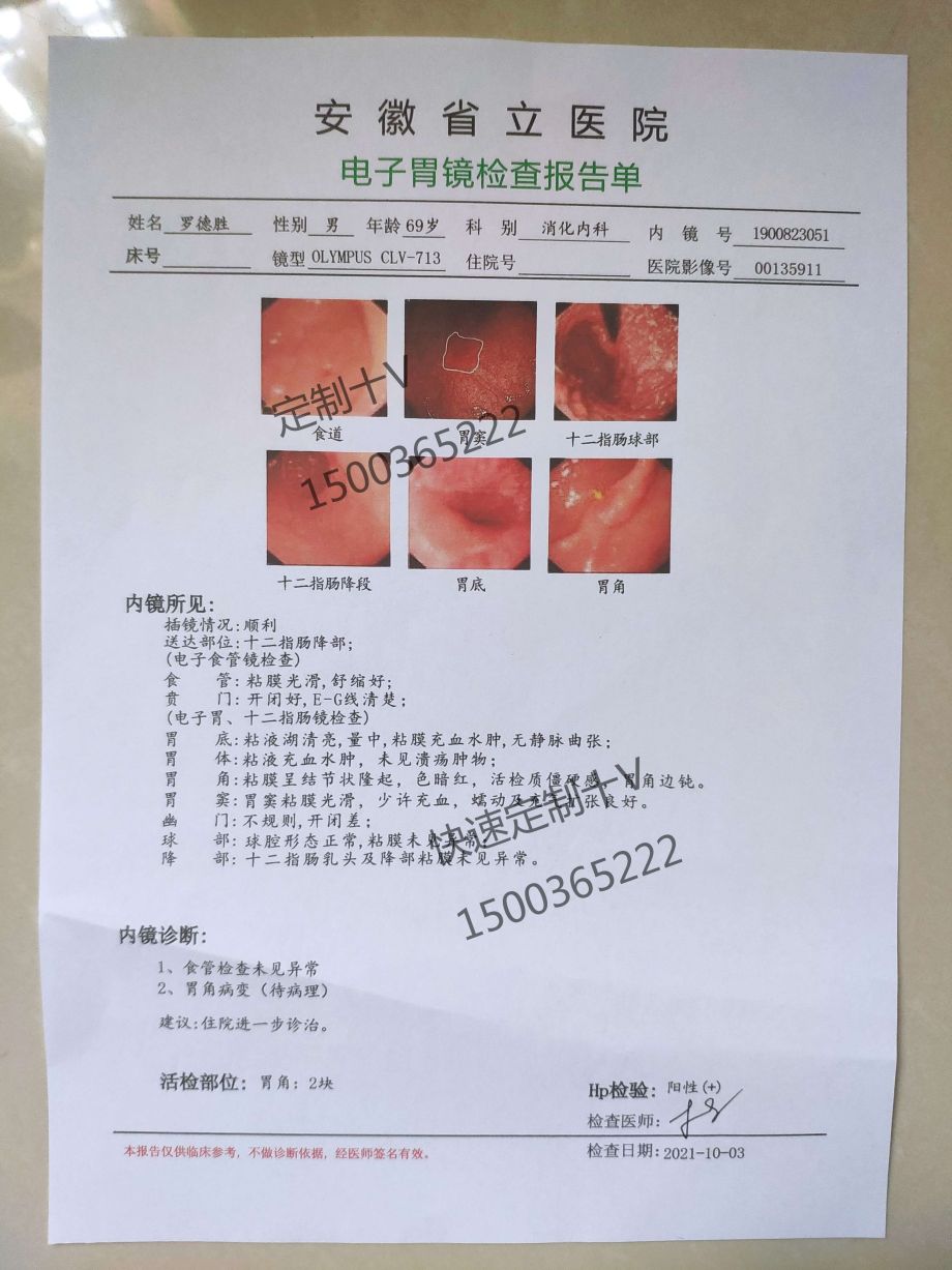 南京妇产科医院代办人流病历病例本胃癌病历肺癌住院单淋巴癌住院病例