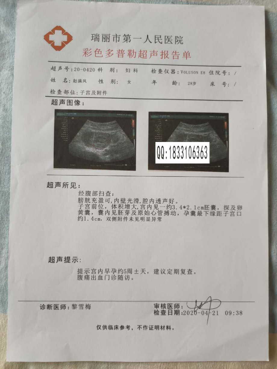 b型超声波关于深圳富士康公司不相信镇江市江滨医院的怀孕急诊病历