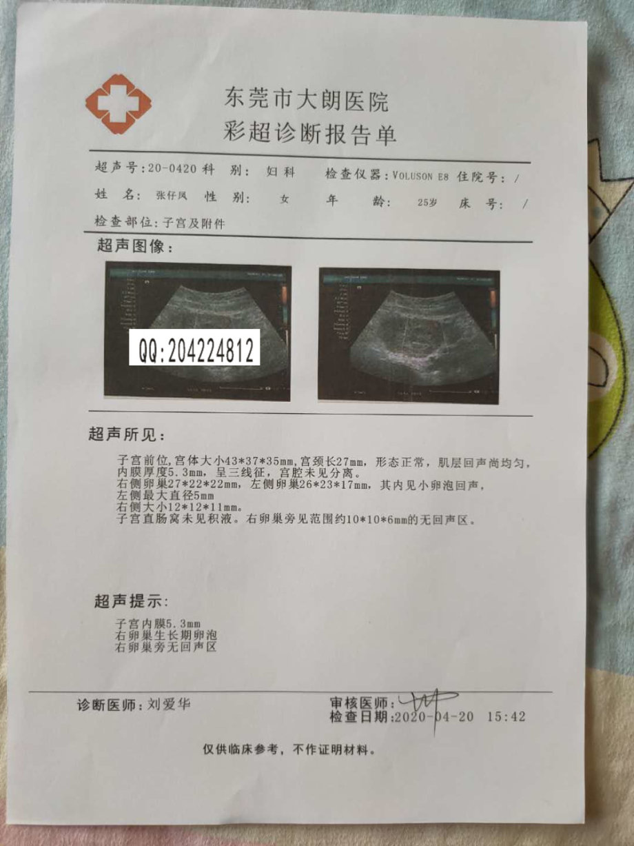 b型超声波关于深圳富士康公司不相信镇江市江滨医院的怀孕急诊病历